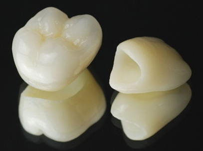 二俣川（横浜市旭区）の歯医者、ニュータウンはぐくみ歯科の保険治療でも「白い歯」に。CAD/CAM冠