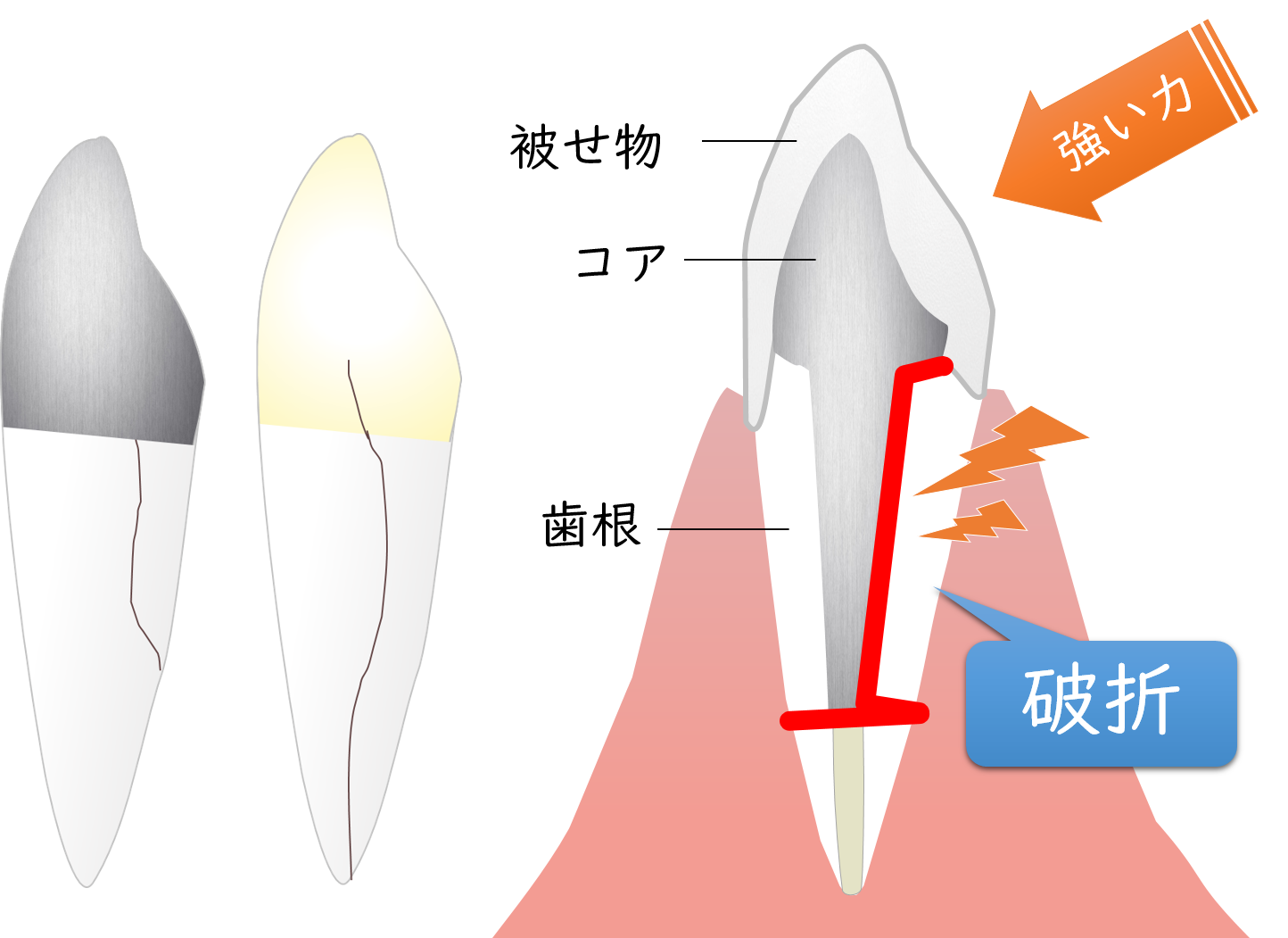二俣川（横浜市旭区）の歯医者、ニュータウンはぐくみ歯科の歯科用ＣＴ